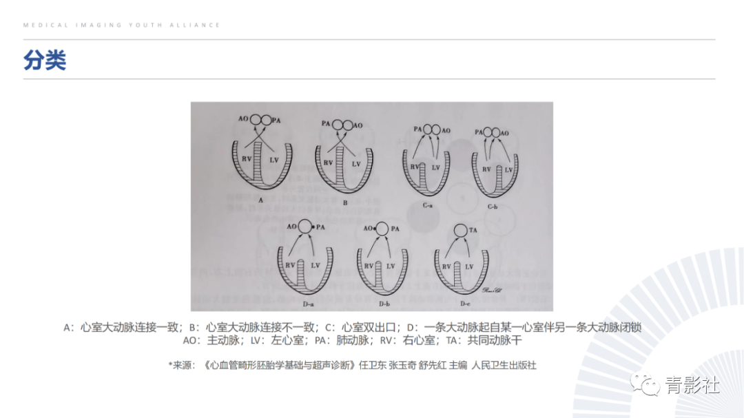 影像PPT - 【PPT】心室大动脉连接异常的先心病的鉴别诊断-5