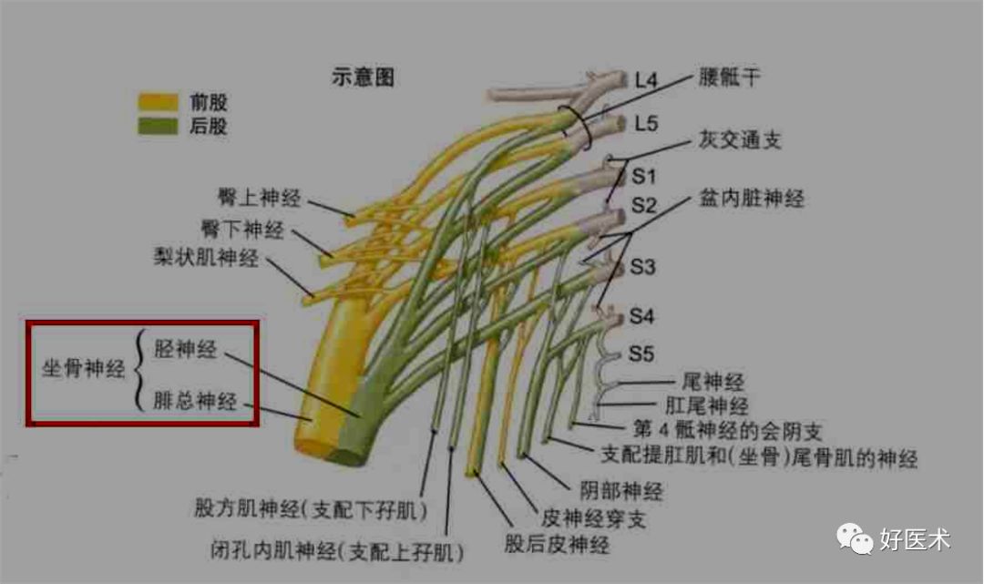 影像PPT - 梨状肌综合征-4 影像PPT - 梨状肌综合征-4