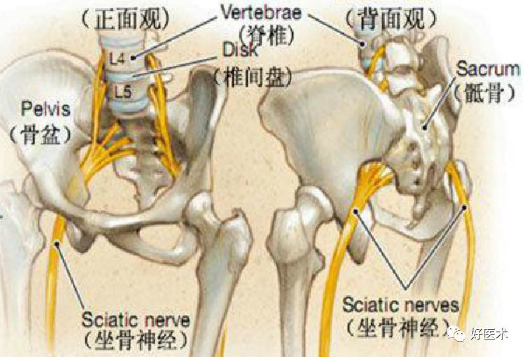 影像PPT - 梨状肌综合征-3 影像PPT - 梨状肌综合征-3