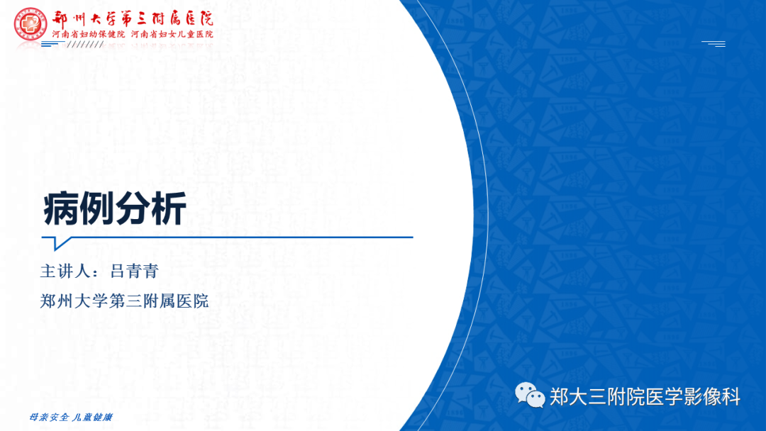影像PPT - 【PPT】颅内表皮样囊肿-1