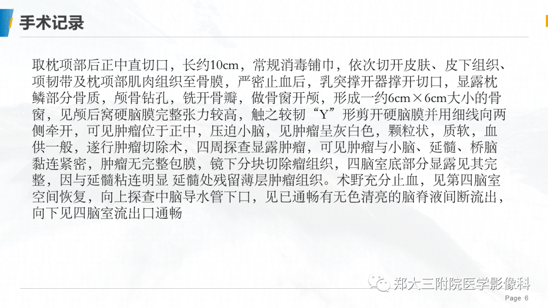 影像PPT - 【PPT】颅内表皮样囊肿-6