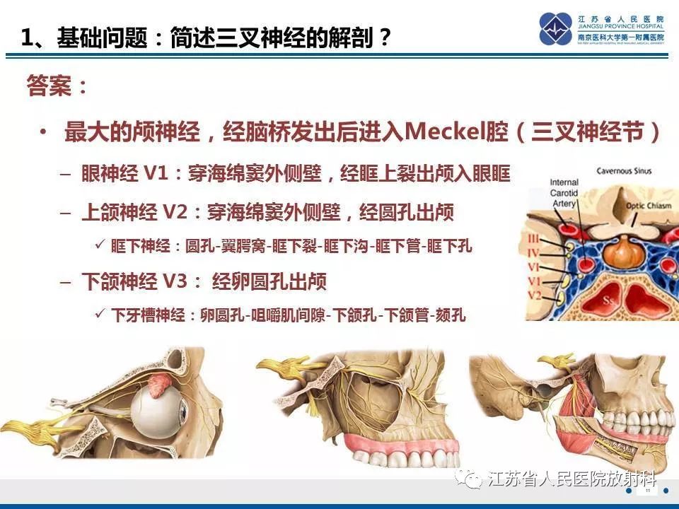 影像PPT - 【PPT】腺样囊腺癌-12