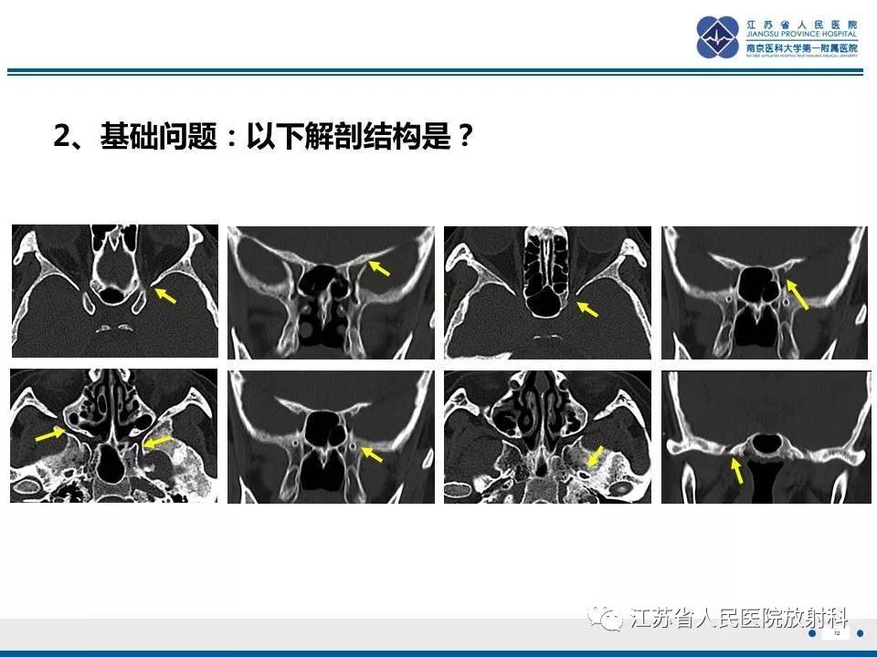 影像PPT - 【PPT】腺样囊腺癌-13