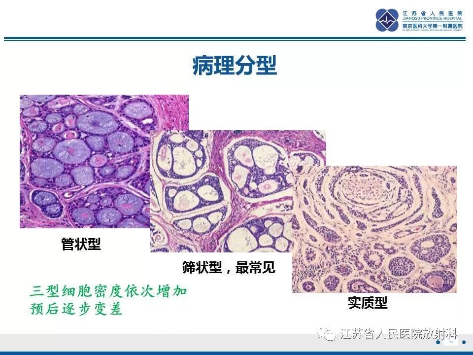 影像PPT - 【PPT】腺样囊腺癌-32