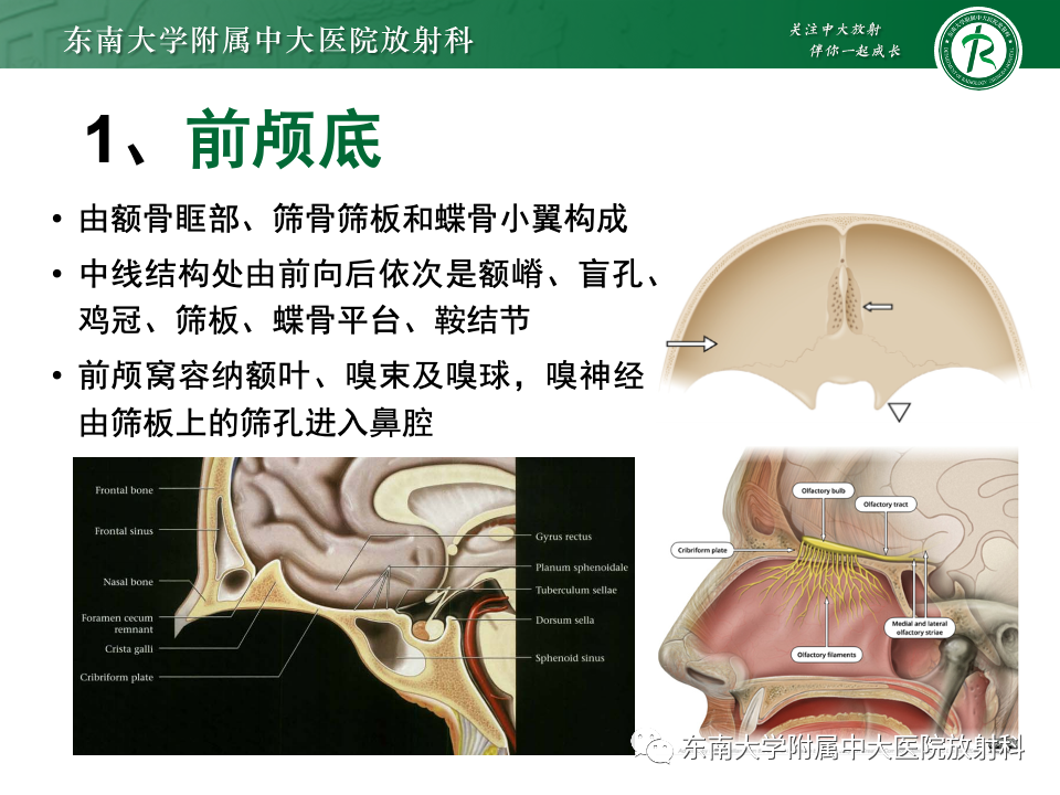 影像PPT - 【PPT】鼻颅底病变随访-7