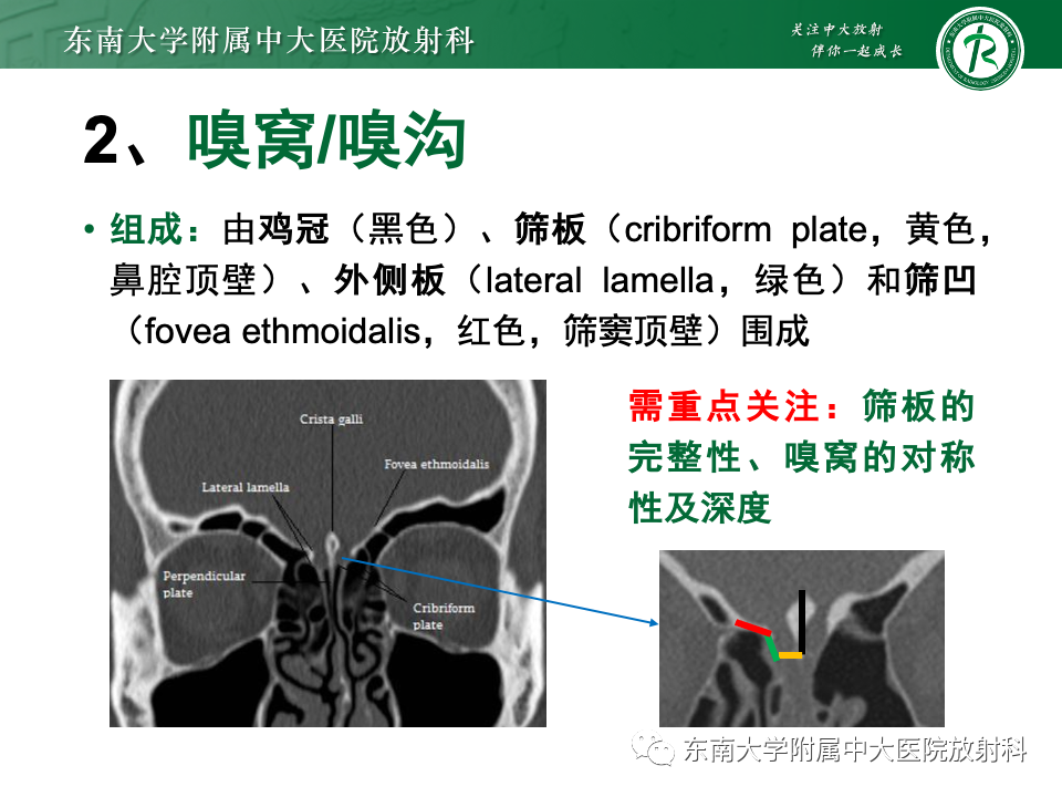 影像PPT - 【PPT】鼻颅底病变随访-8