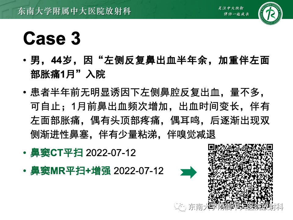 影像PPT - 【PPT】鼻颅底病变随访-28