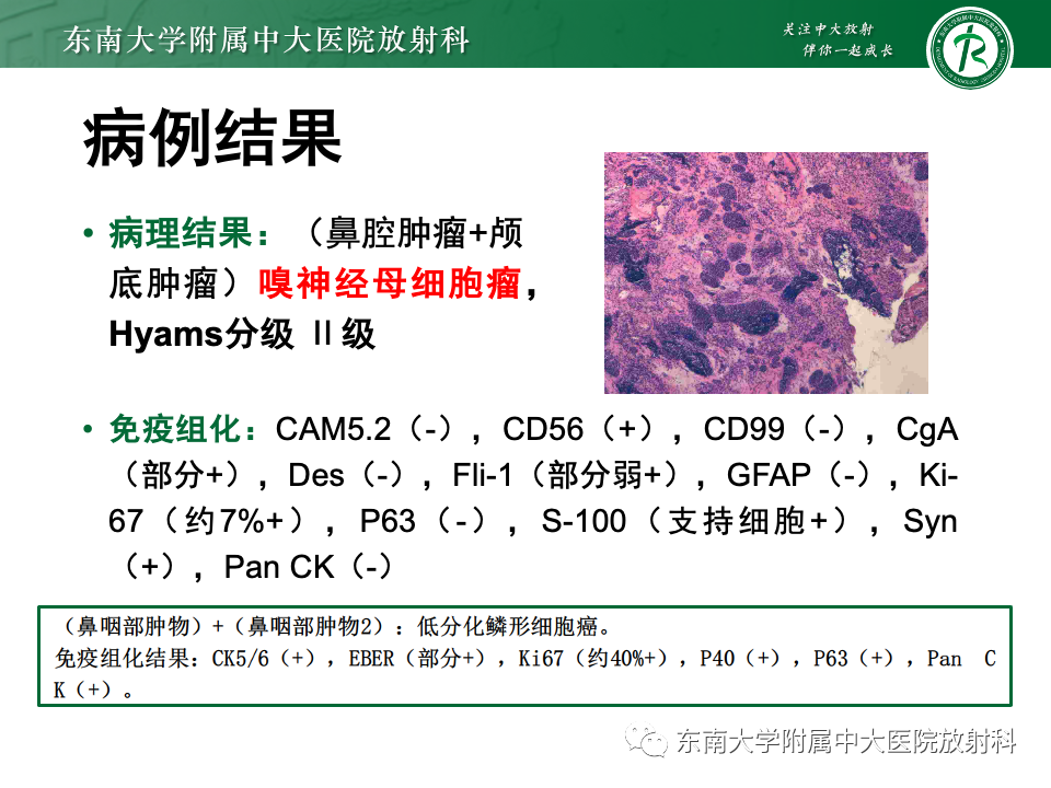 影像PPT - 【PPT】鼻颅底病变随访-34