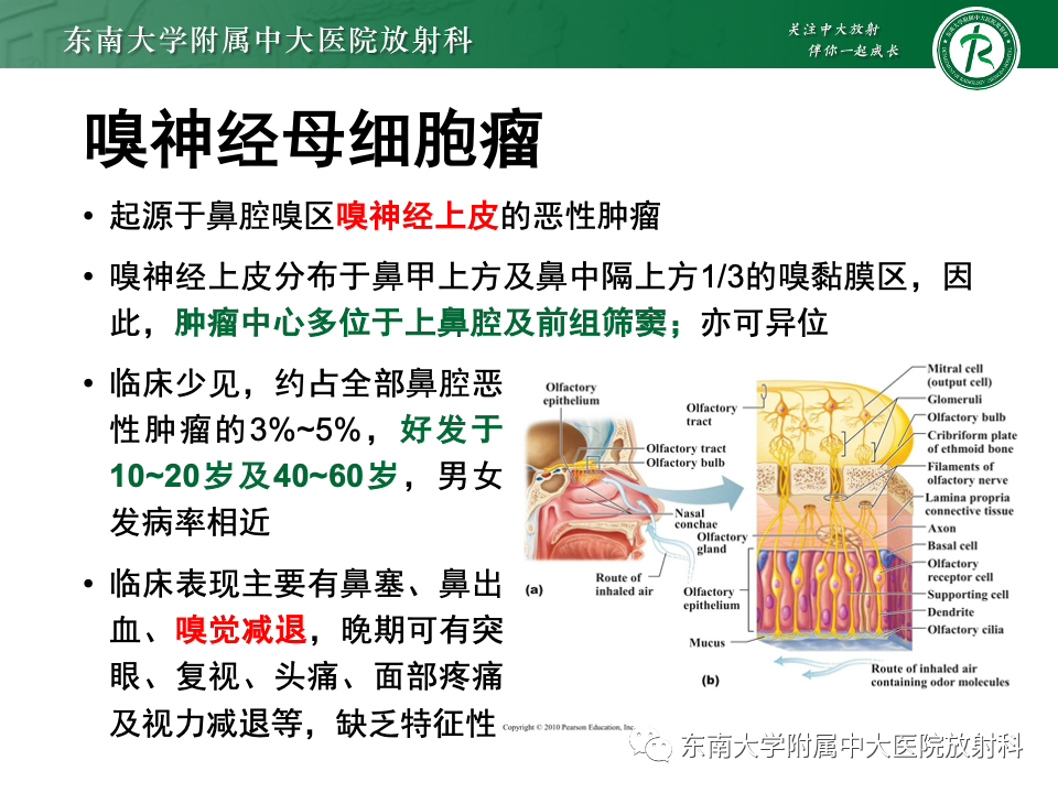 影像PPT - 【PPT】鼻颅底病变随访-36