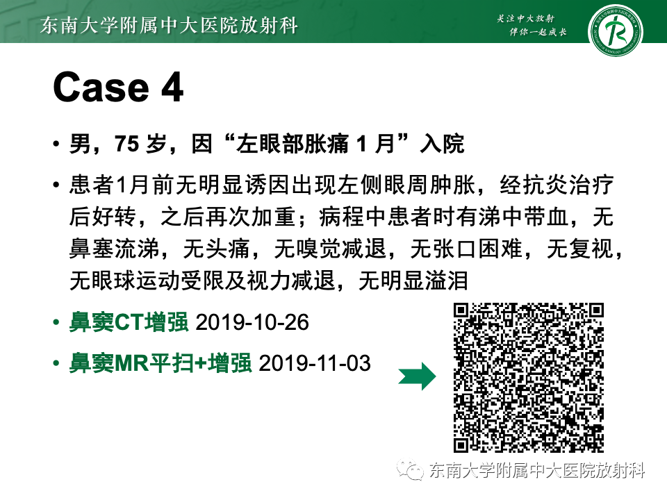 影像PPT - 【PPT】鼻颅底病变随访-41