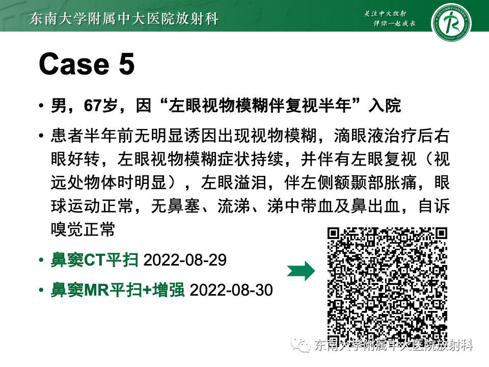 影像PPT - 【PPT】鼻颅底病变随访-50