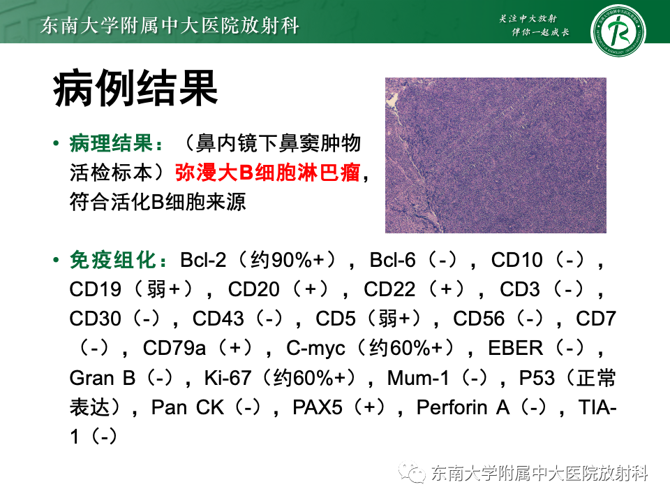 影像PPT - 【PPT】鼻颅底病变随访-54