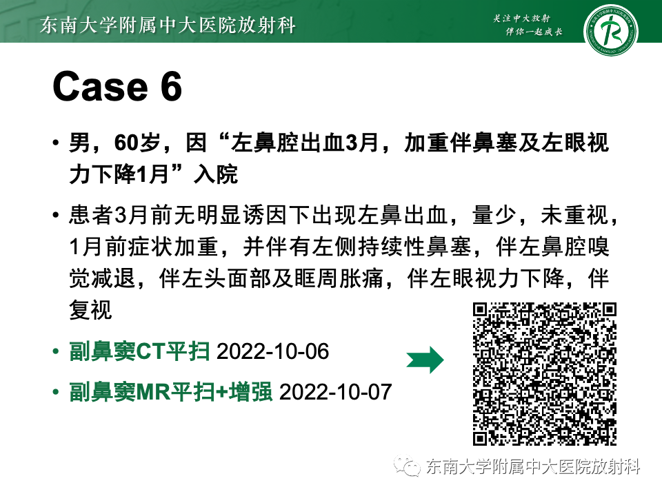 影像PPT - 【PPT】鼻颅底病变随访-60