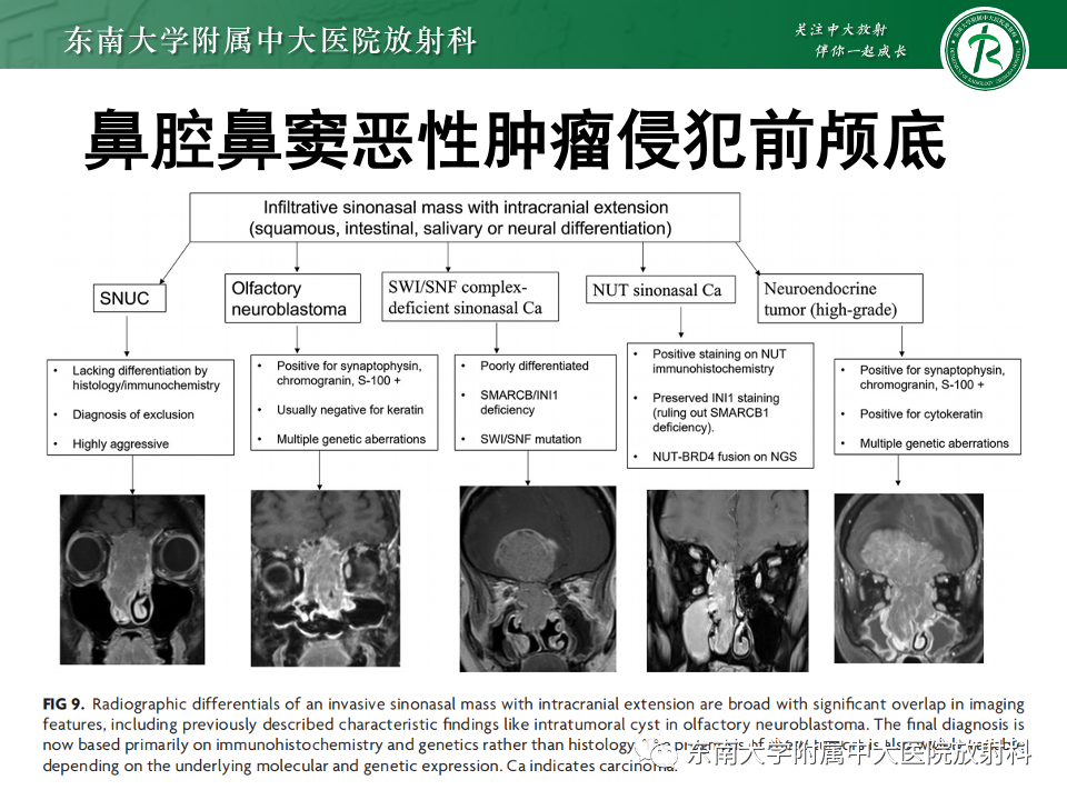 影像PPT - 【PPT】鼻颅底病变随访-70