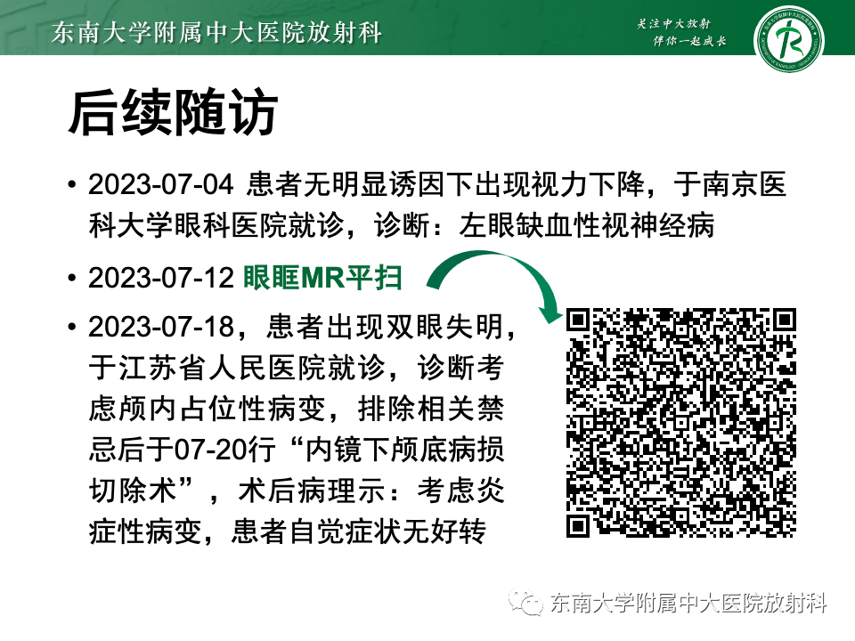 影像PPT - 【PPT】鼻颅底病变随访-78