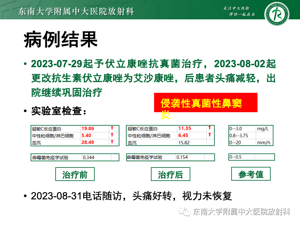 影像PPT - 【PPT】鼻颅底病变随访-86