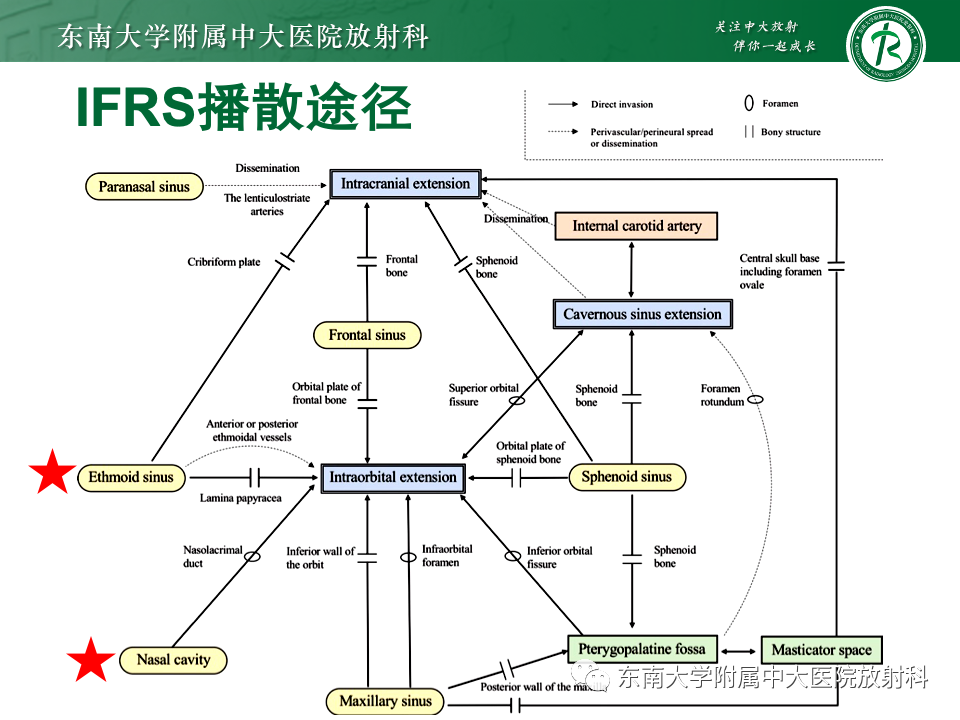 影像PPT - 【PPT】鼻颅底病变随访-90