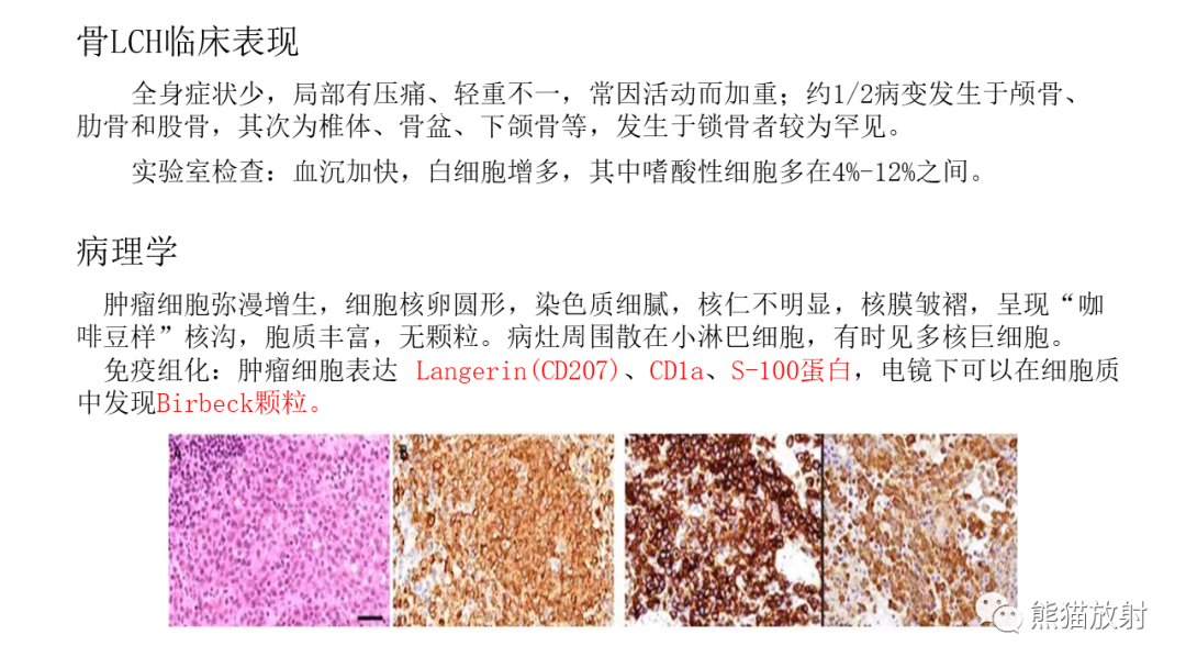 影像PPT - 【病例】锁骨嗜酸性肉芽肿/朗格汉斯组织细胞增生症2例CT及MR影像-18