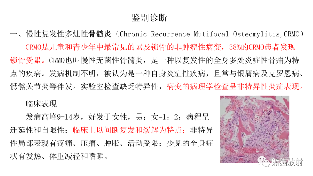影像PPT - 【病例】锁骨嗜酸性肉芽肿/朗格汉斯组织细胞增生症2例CT及MR影像-23