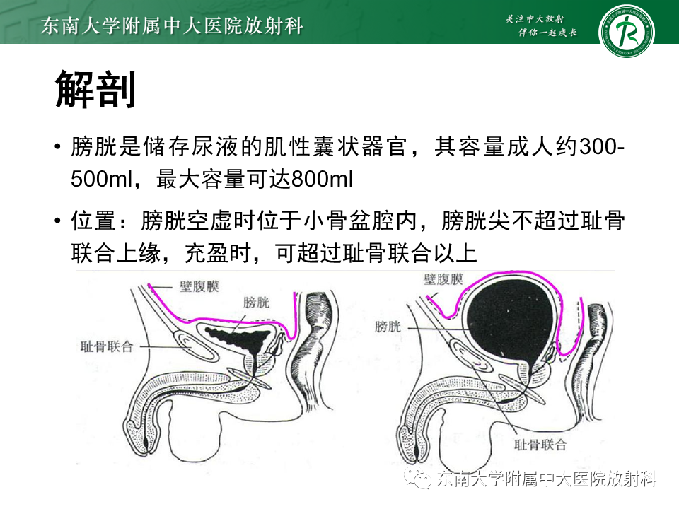 影像PPT - 【PPT】膀胱平滑肌瘤-3
