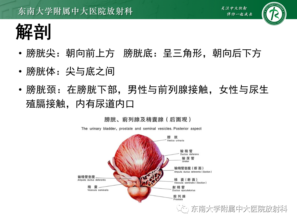 影像PPT - 【PPT】膀胱平滑肌瘤-4