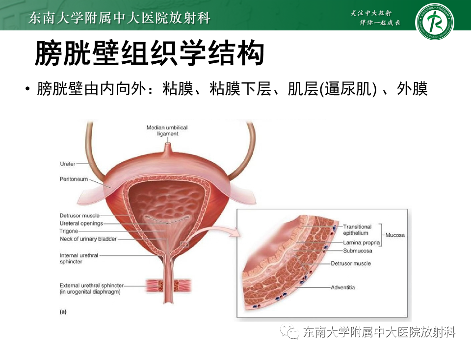 影像PPT - 【PPT】膀胱平滑肌瘤-5
