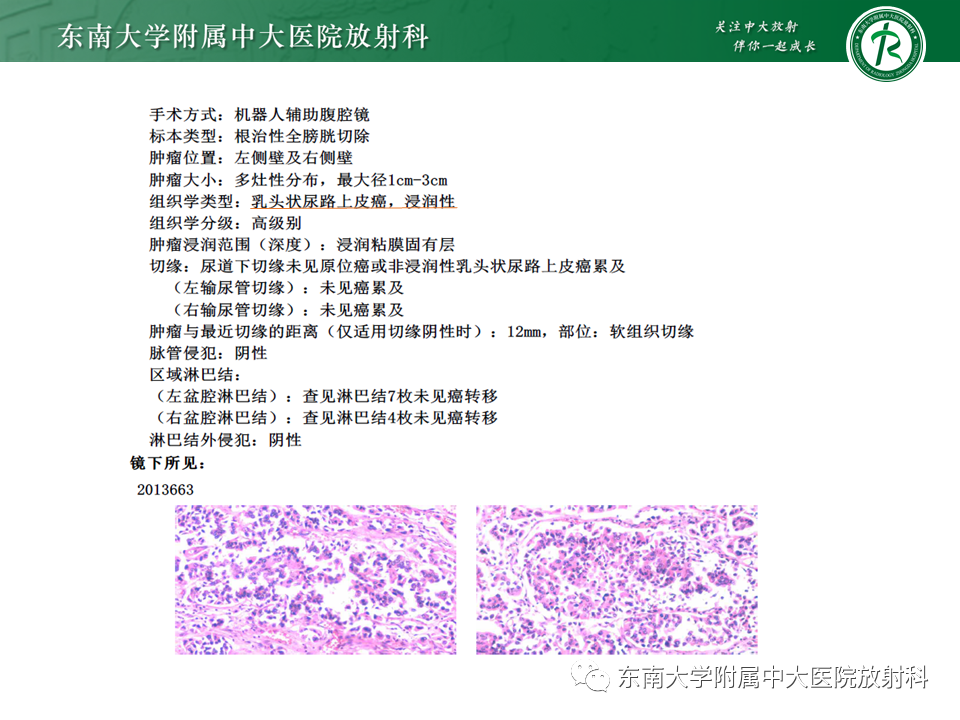 影像PPT - 【PPT】膀胱平滑肌瘤-27