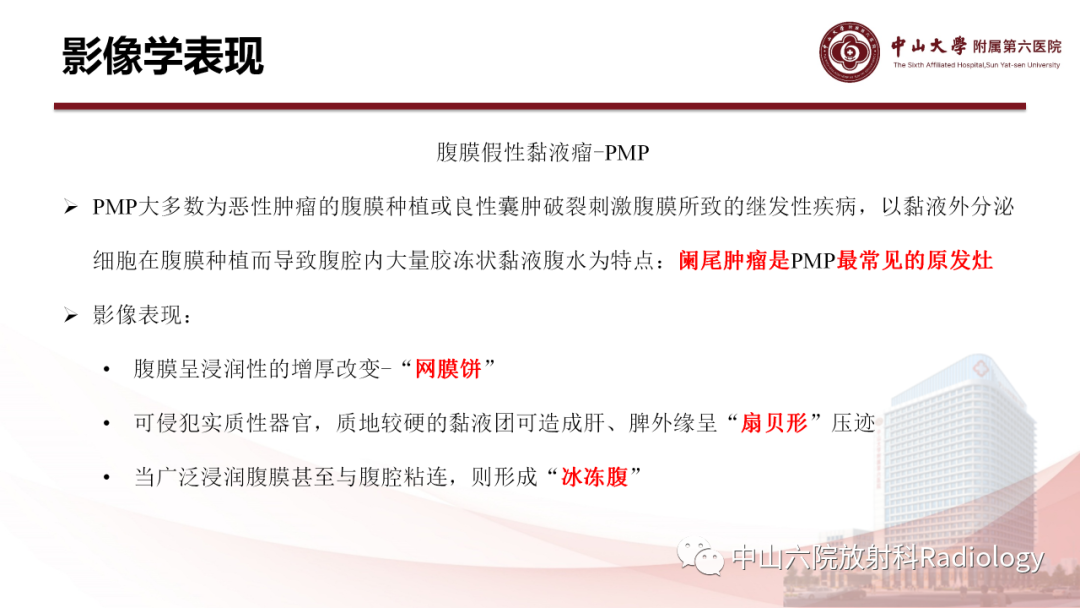 影像PPT - 【PPT】 阑尾低级别黏液性肿瘤影像学表现-7