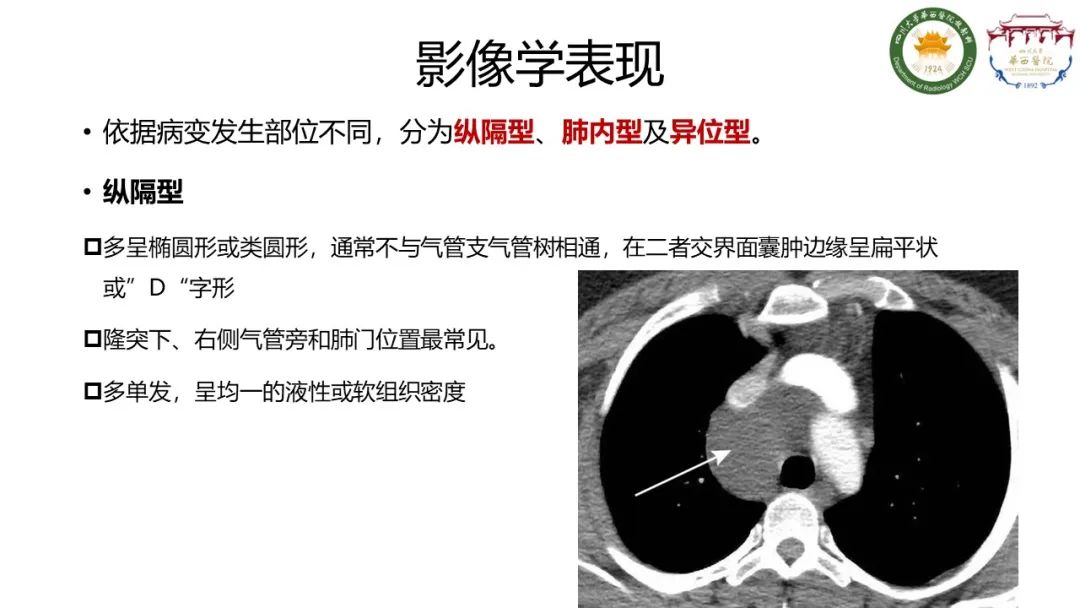 影像PPT - 【病例】支气管源性囊肿1例CT影像-7