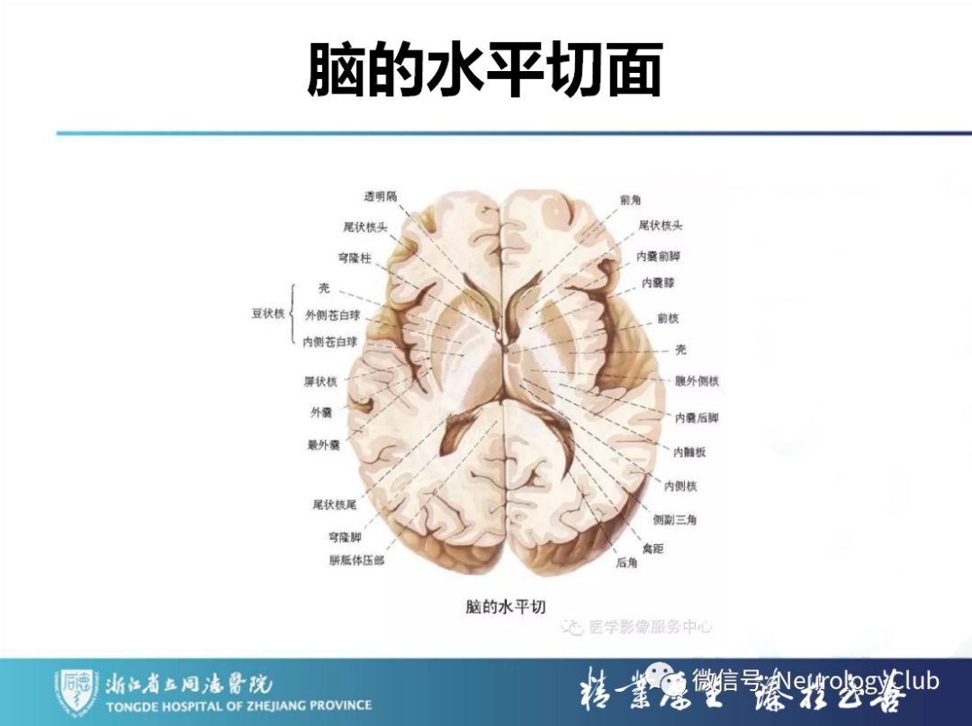 影像PPT - 【PPT】双侧基底节病变的影像诊断和鉴别诊断-5