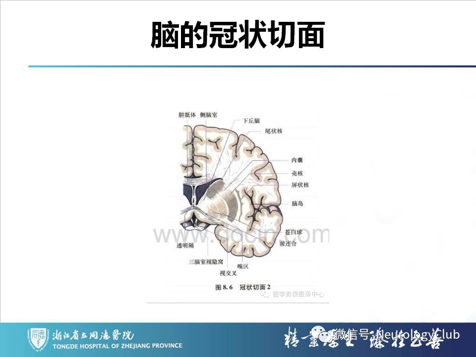 影像PPT - 【PPT】双侧基底节病变的影像诊断和鉴别诊断-6