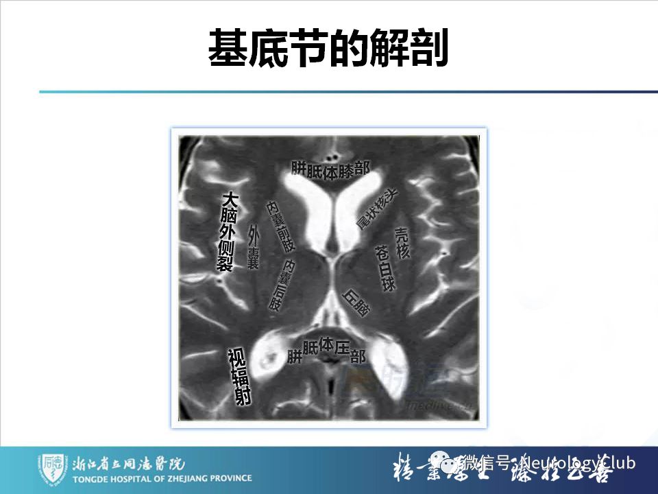 影像PPT - 【PPT】双侧基底节病变的影像诊断和鉴别诊断-16
