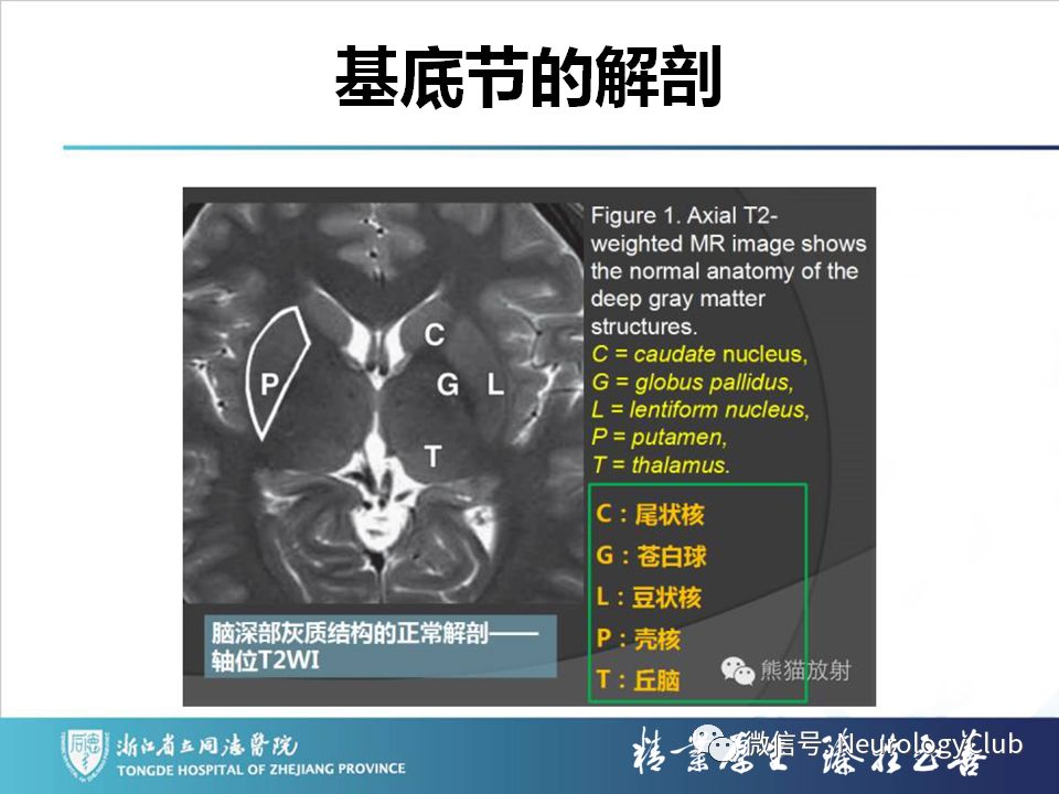 影像PPT - 【PPT】双侧基底节病变的影像诊断和鉴别诊断-17