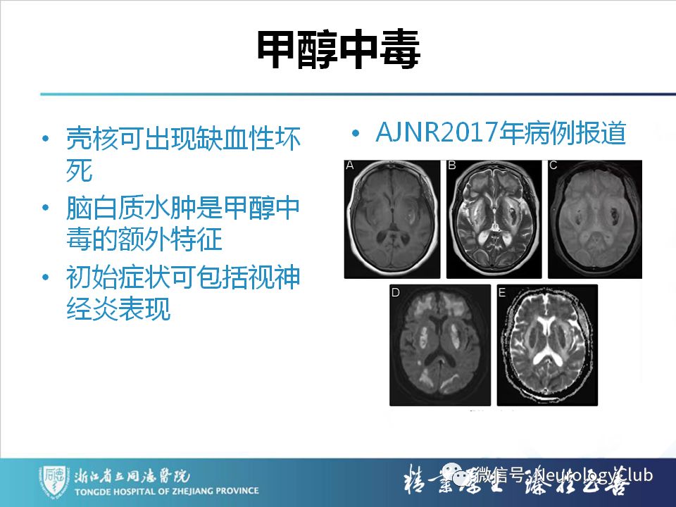 影像PPT - 【PPT】双侧基底节病变的影像诊断和鉴别诊断-28