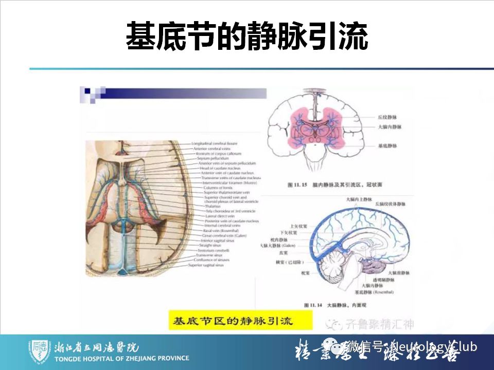 影像PPT - 【PPT】双侧基底节病变的影像诊断和鉴别诊断-96