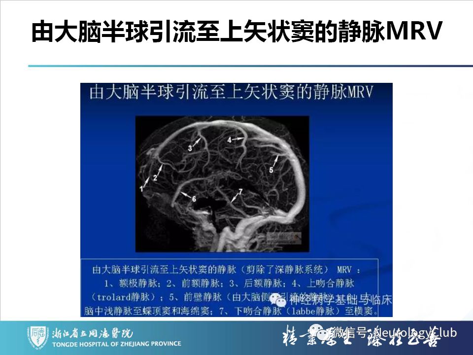 影像PPT - 【PPT】双侧基底节病变的影像诊断和鉴别诊断-98