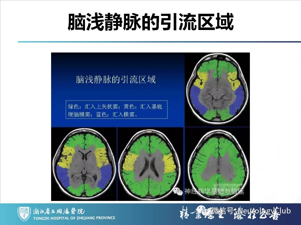 影像PPT - 【PPT】双侧基底节病变的影像诊断和鉴别诊断-99
