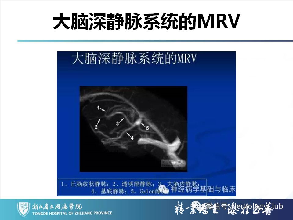影像PPT - 【PPT】双侧基底节病变的影像诊断和鉴别诊断-100