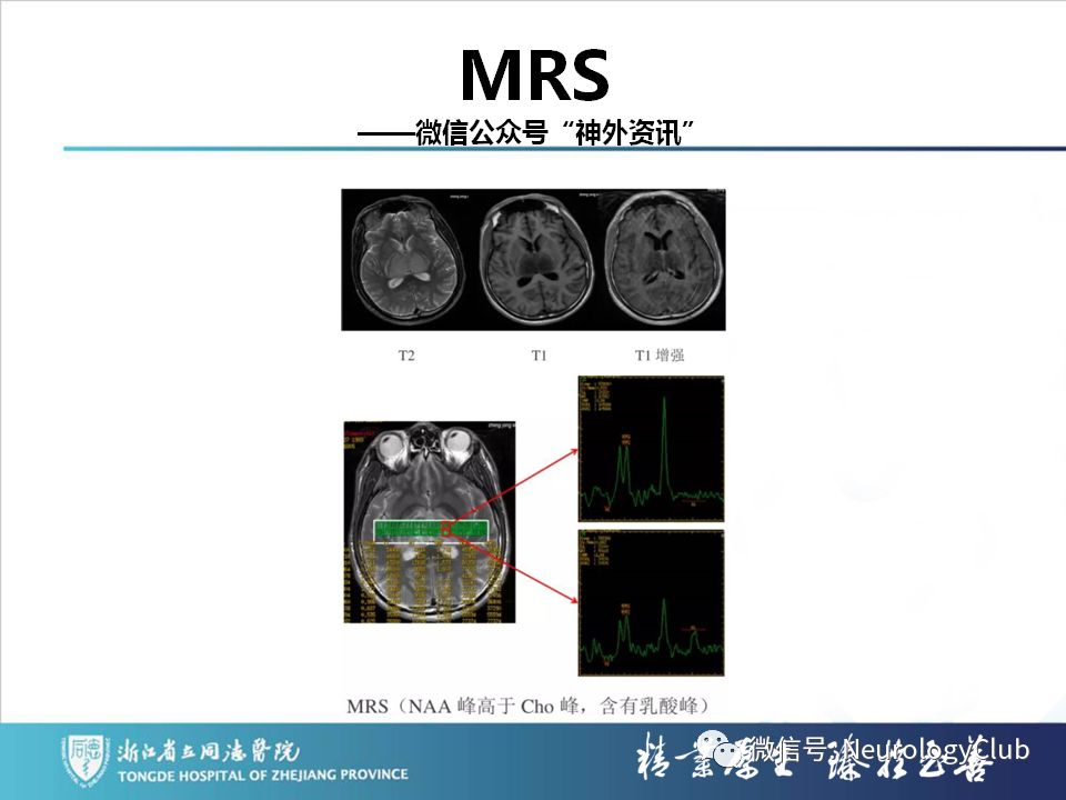 影像PPT - 【PPT】双侧基底节病变的影像诊断和鉴别诊断-105