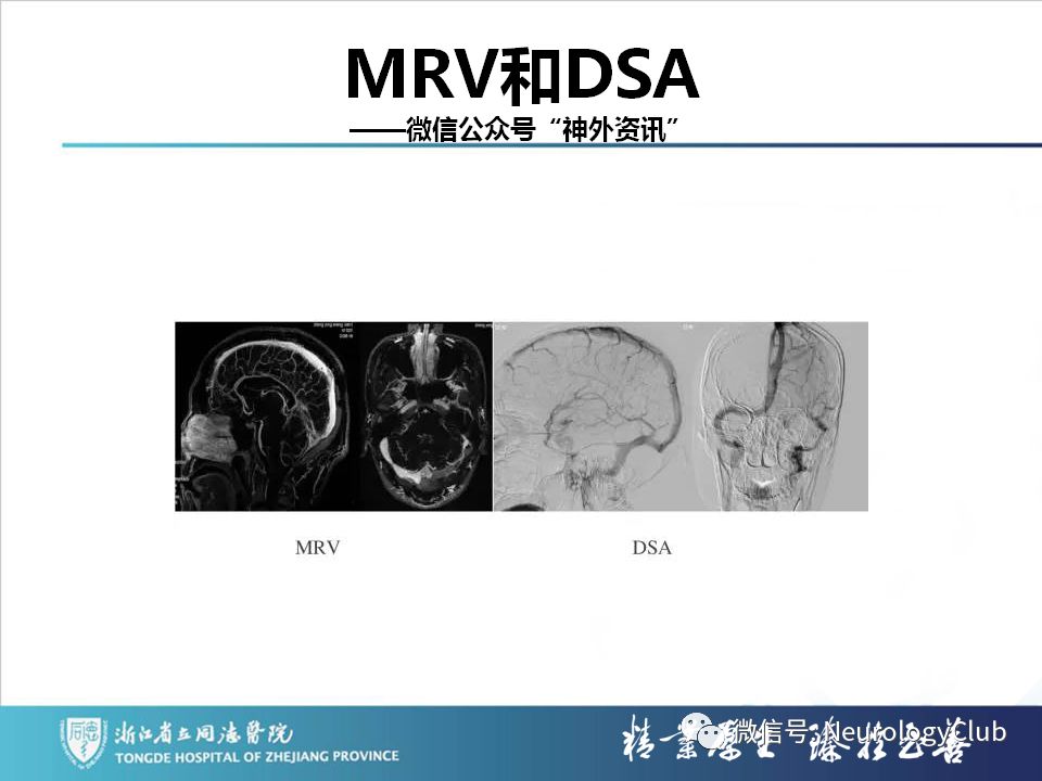 影像PPT - 【PPT】双侧基底节病变的影像诊断和鉴别诊断-106