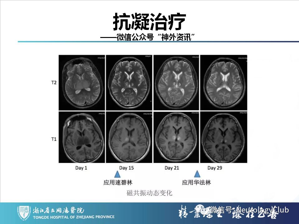影像PPT - 【PPT】双侧基底节病变的影像诊断和鉴别诊断-107