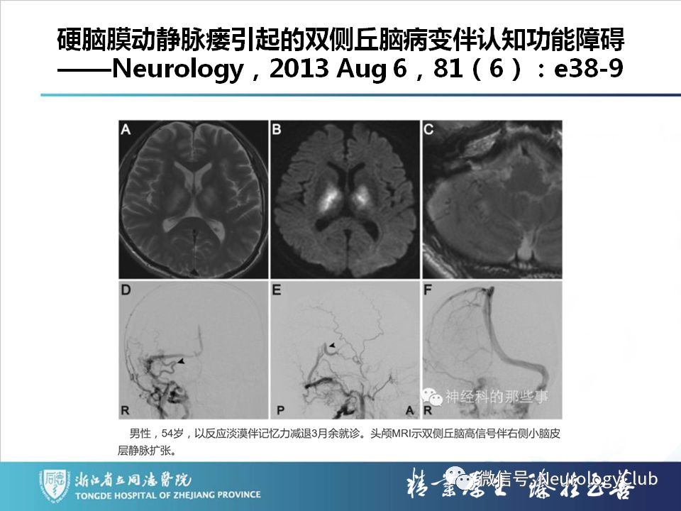 影像PPT - 【PPT】双侧基底节病变的影像诊断和鉴别诊断-110