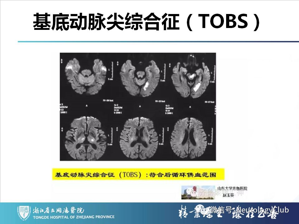 影像PPT - 【PPT】双侧基底节病变的影像诊断和鉴别诊断-114