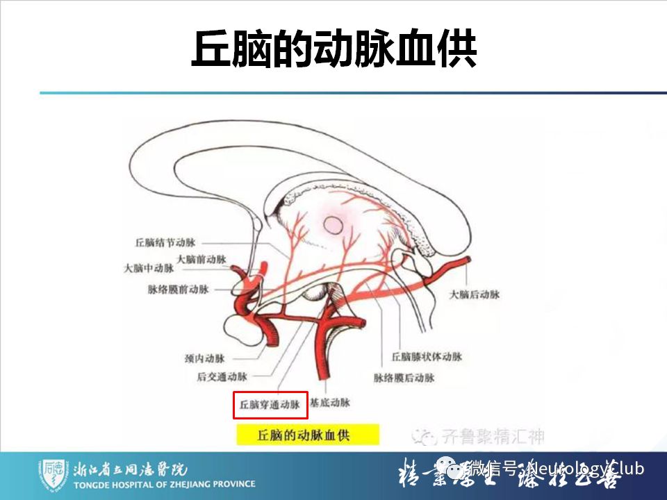 影像PPT - 【PPT】双侧基底节病变的影像诊断和鉴别诊断-116