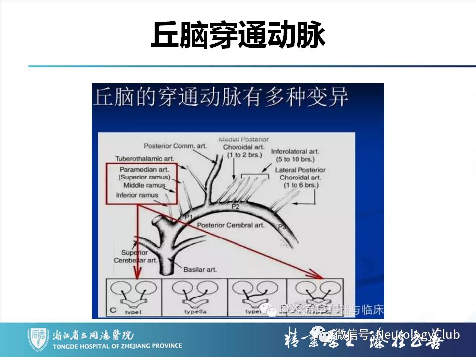影像PPT - 【PPT】双侧基底节病变的影像诊断和鉴别诊断-117