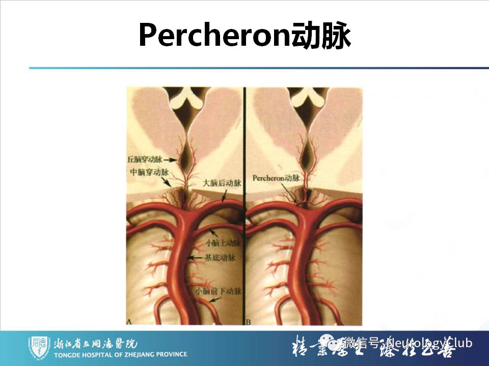影像PPT - 【PPT】双侧基底节病变的影像诊断和鉴别诊断-118