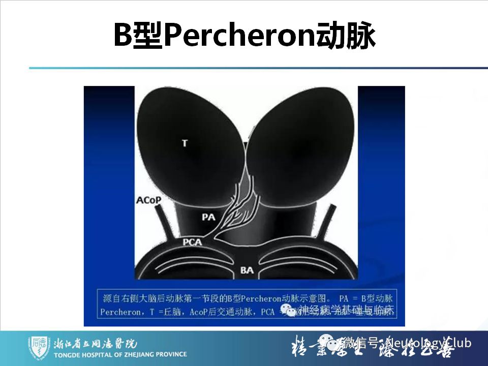 影像PPT - 【PPT】双侧基底节病变的影像诊断和鉴别诊断-120