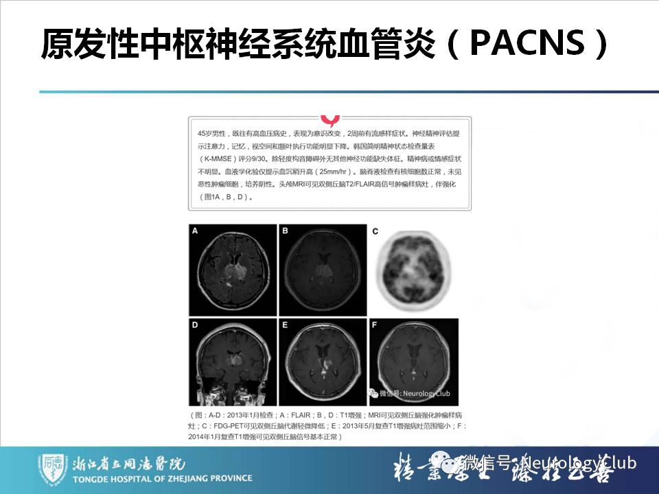 影像PPT - 【PPT】双侧基底节病变的影像诊断和鉴别诊断-127