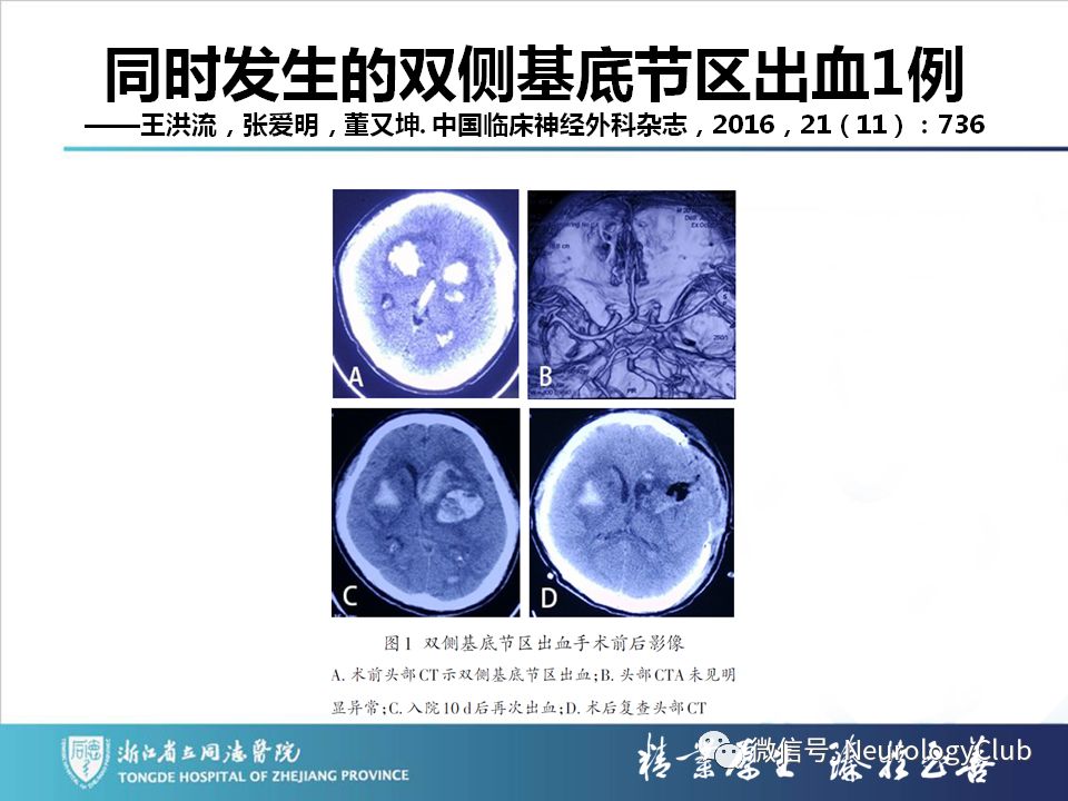 影像PPT - 【PPT】双侧基底节病变的影像诊断和鉴别诊断-131