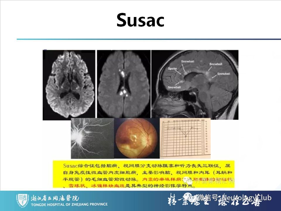 影像PPT - 【PPT】双侧基底节病变的影像诊断和鉴别诊断-130